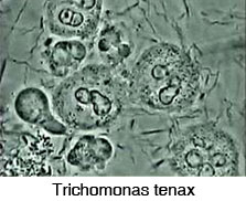 Trichomonas tenax