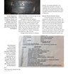 1969 Chevrolet Chevelle SS 396 Muscle Cars In Detail No. 12
